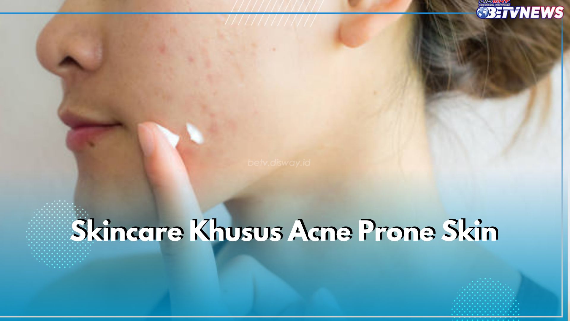 Kamu Punya Tipe Acne Prone Skin? Ini 6 Skincare Khusus untuk Tipe Kulitmu, Ada Pembersih hingga Sunscreen