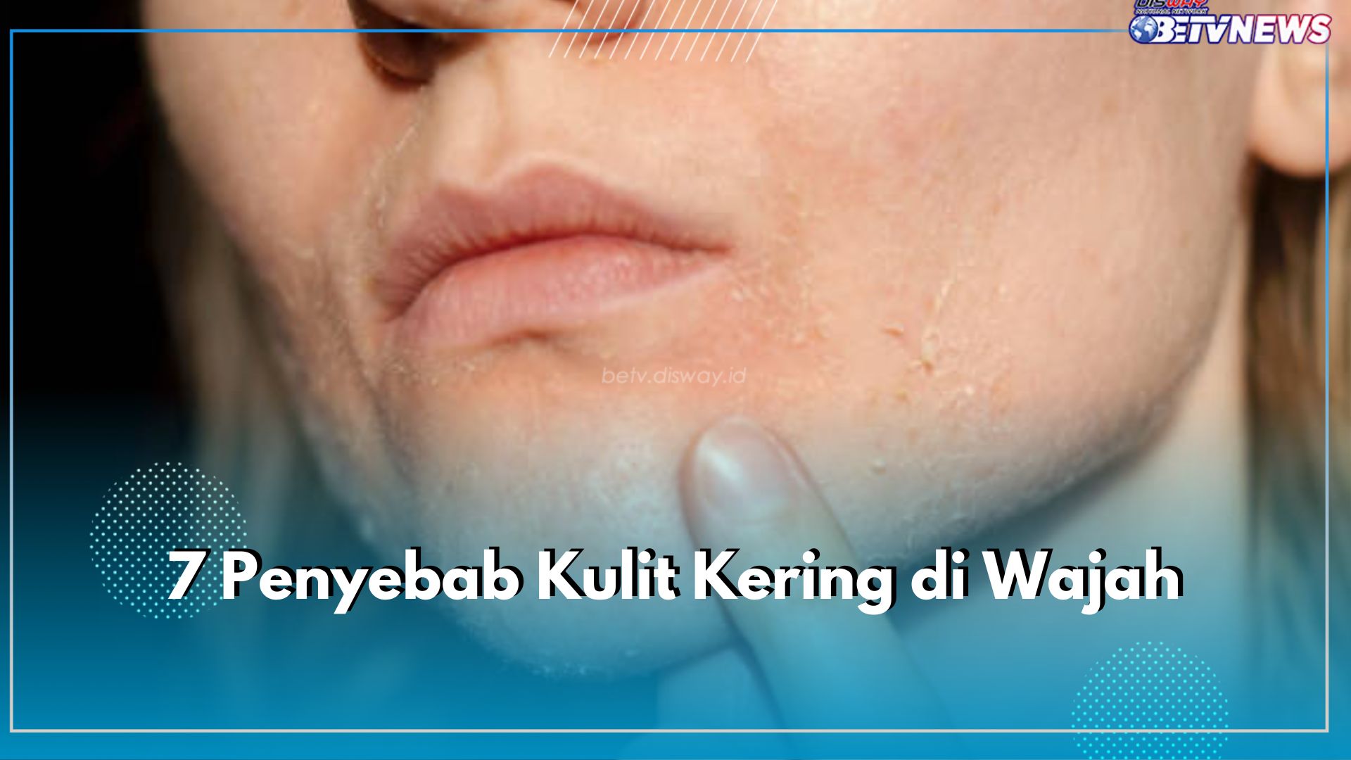 7 Penyebab Kulit Kering di Wajah Ini Perlu Kamu Ketahui, Salah Satuya Tidak Pakai Pelembab