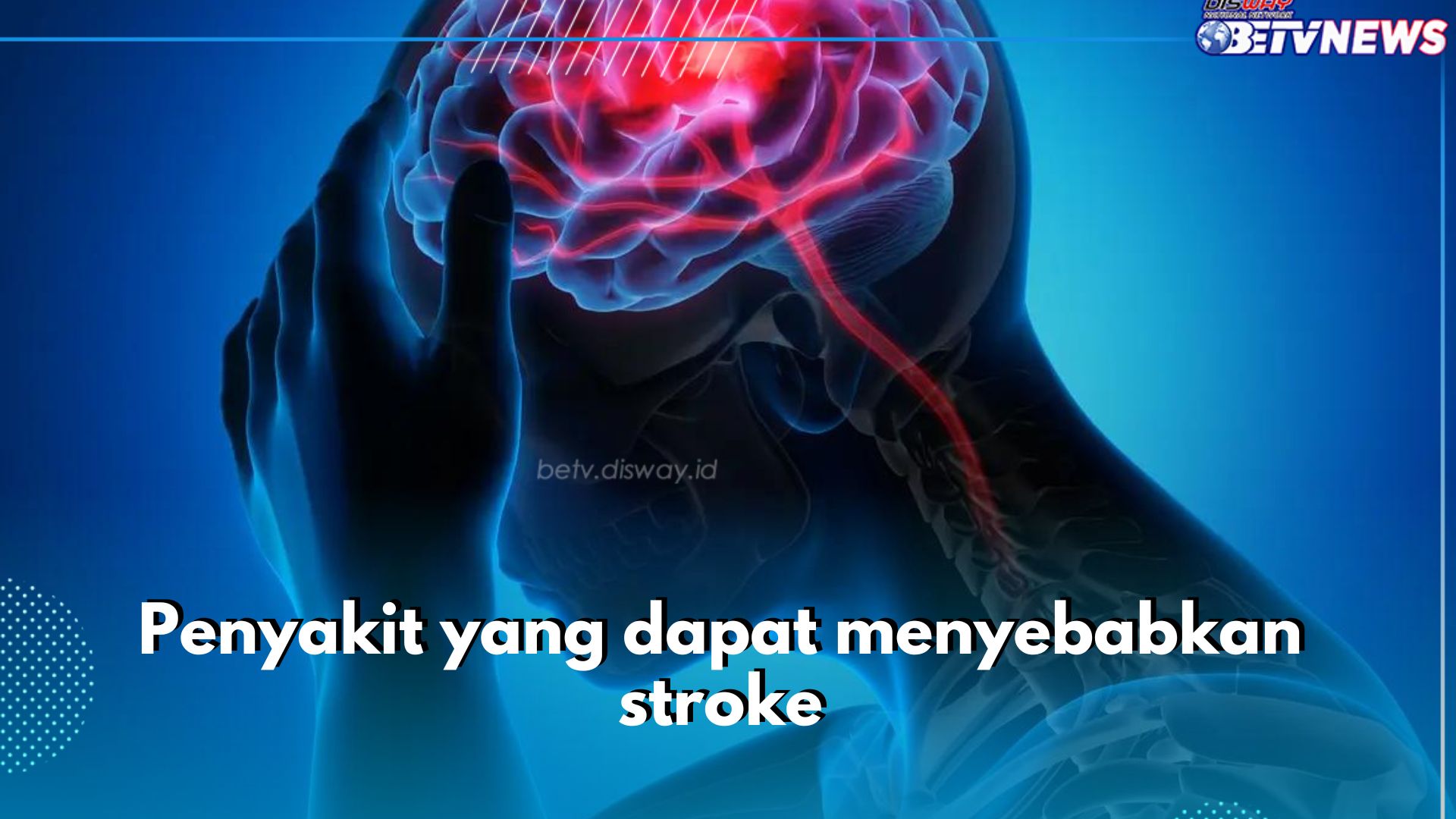 8 Penyakit Ini Dapat Sebabkan Stroke, Darah Tinggi Termasuk Salah Satunya