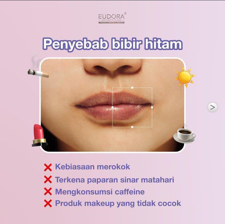 Punya Bibir Hitam? Ini 7 Cara Mudah Mengatasinya, Jadikan Bibirmu Sehat Alami