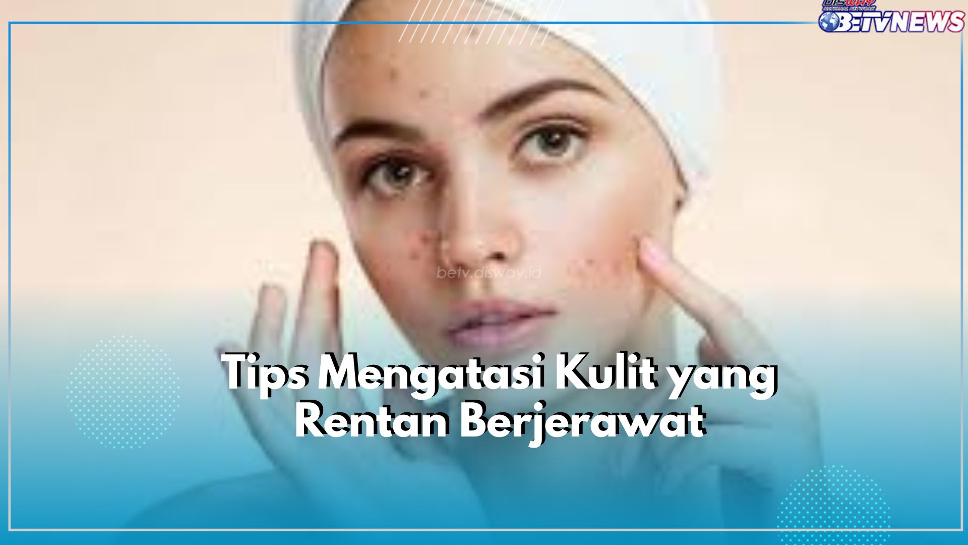Kulitmu Rentan Terkena Jerawat? Coba Atasi dengan 6 Tips Ini, Salah Satunya Jangan Terlalu Stres