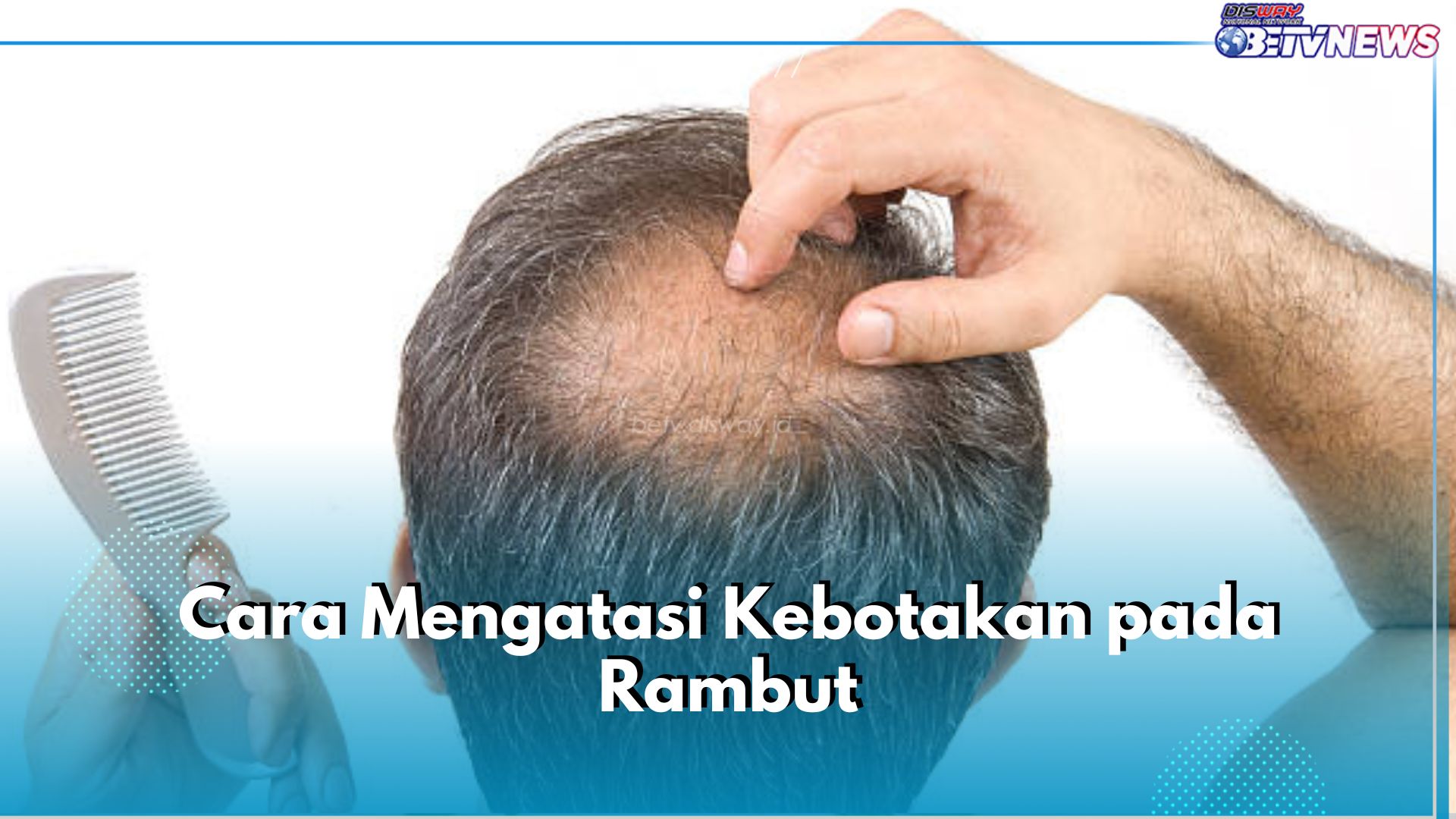 Rambutmu Mulai Tunjukkan Tanda Kebotakan? Atasi dengan 6 Cara Mudah Ini