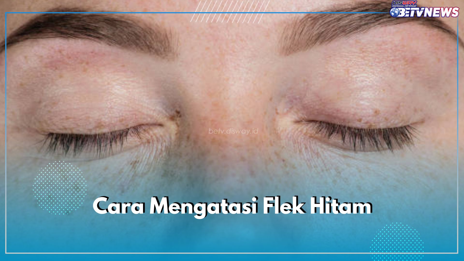 5 Trik Mengatasi Flek Hitam Agar Cepat Mengelupas, Gunakan Bahan Alami