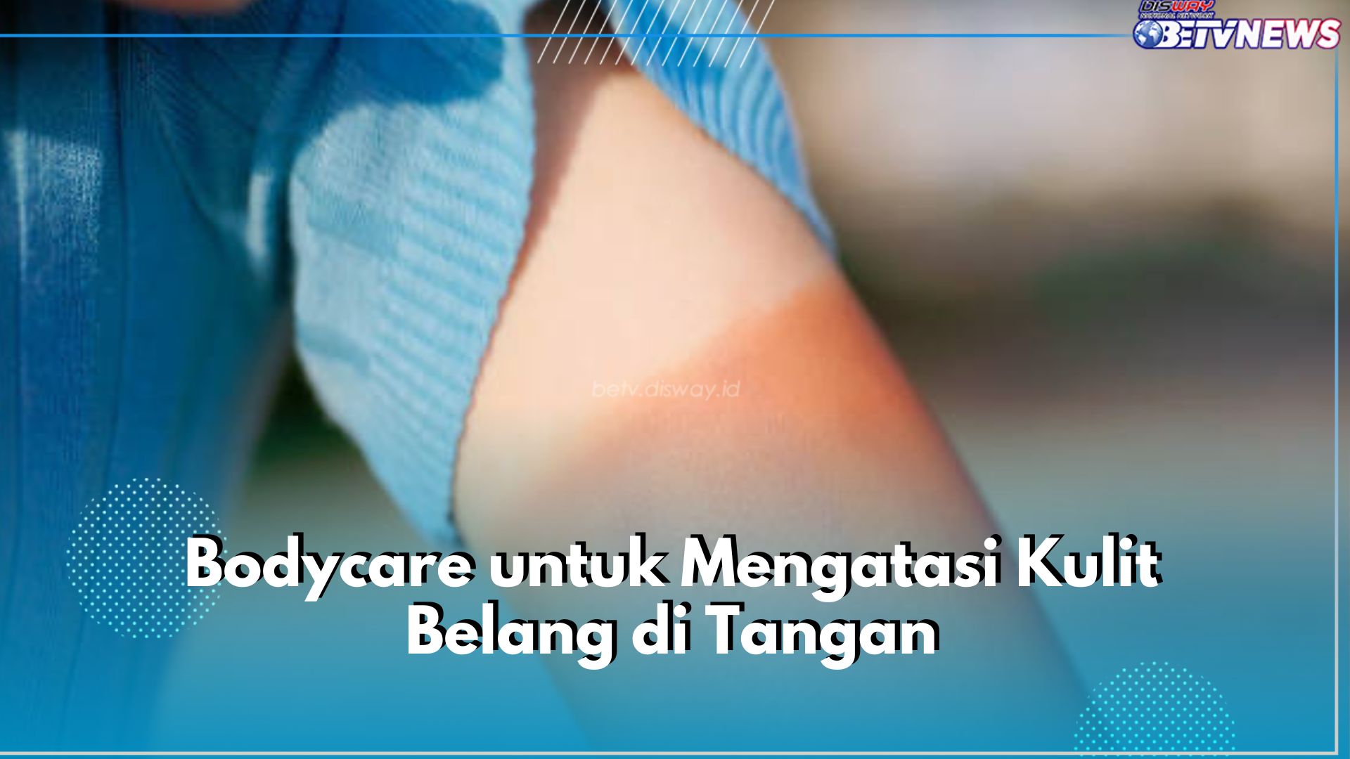 Kulit Tanganmu Belang? Gunakan 6 Jenis Bodycare Ini untuk Mengatasinya, Cek Segera!