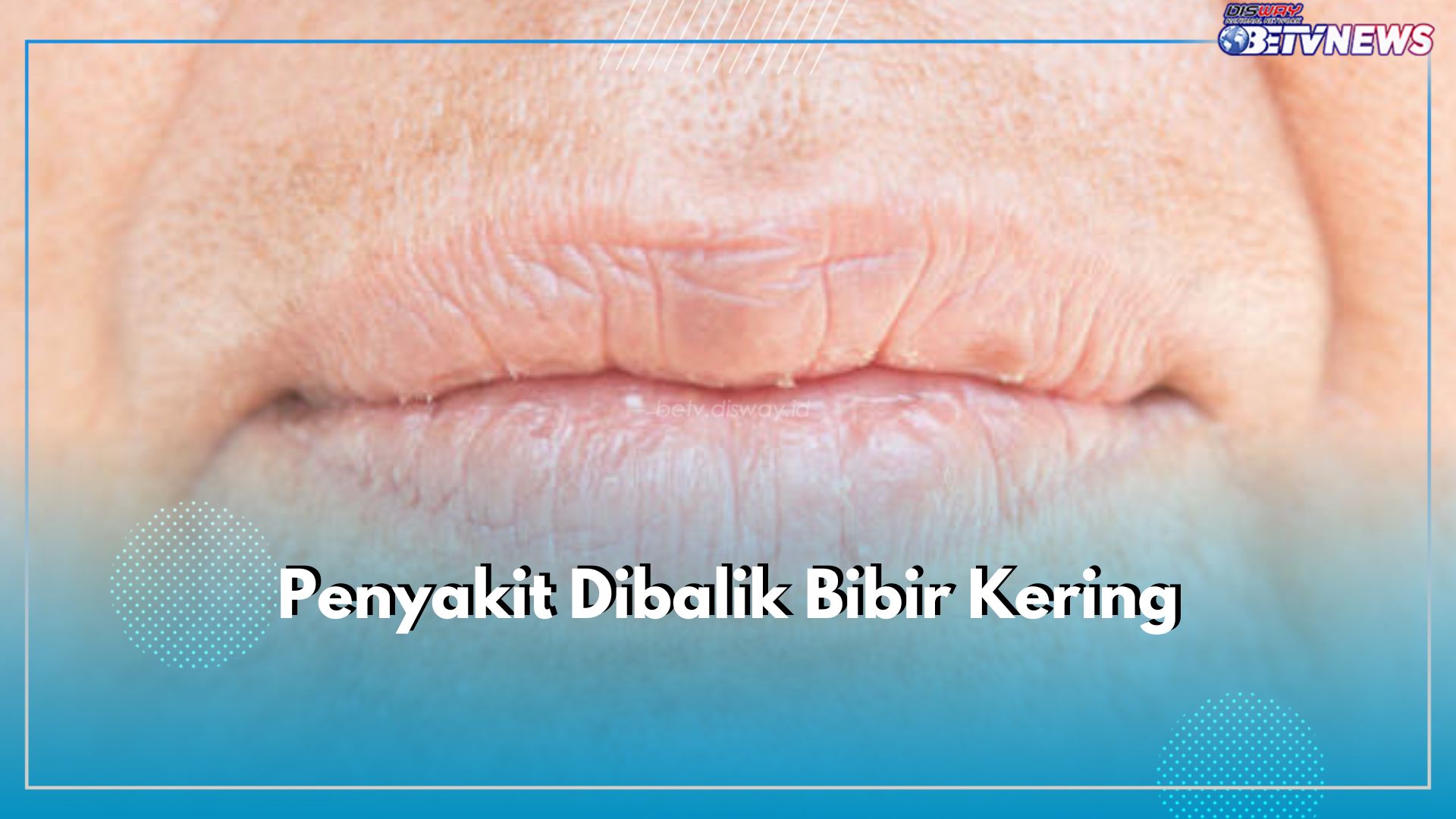 Jangan Abaikan Bibir Kering Karena Bisa Jadi Tanda 5 Penyakit Ini, Cek Apa Saja!