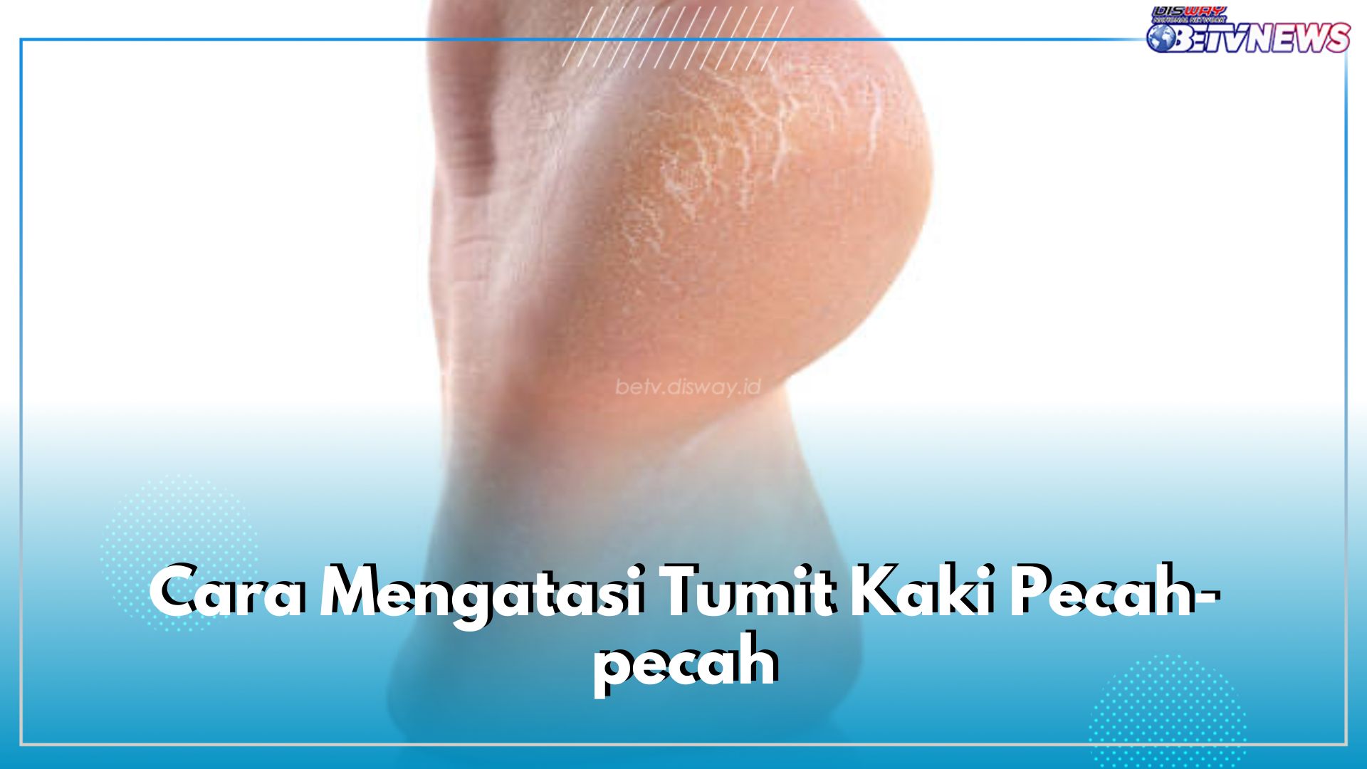 Ini 5 Cara Mudah Atasi Tumit Kaki Pecah-pecah, Coba Gunakan Pelembap Khusus