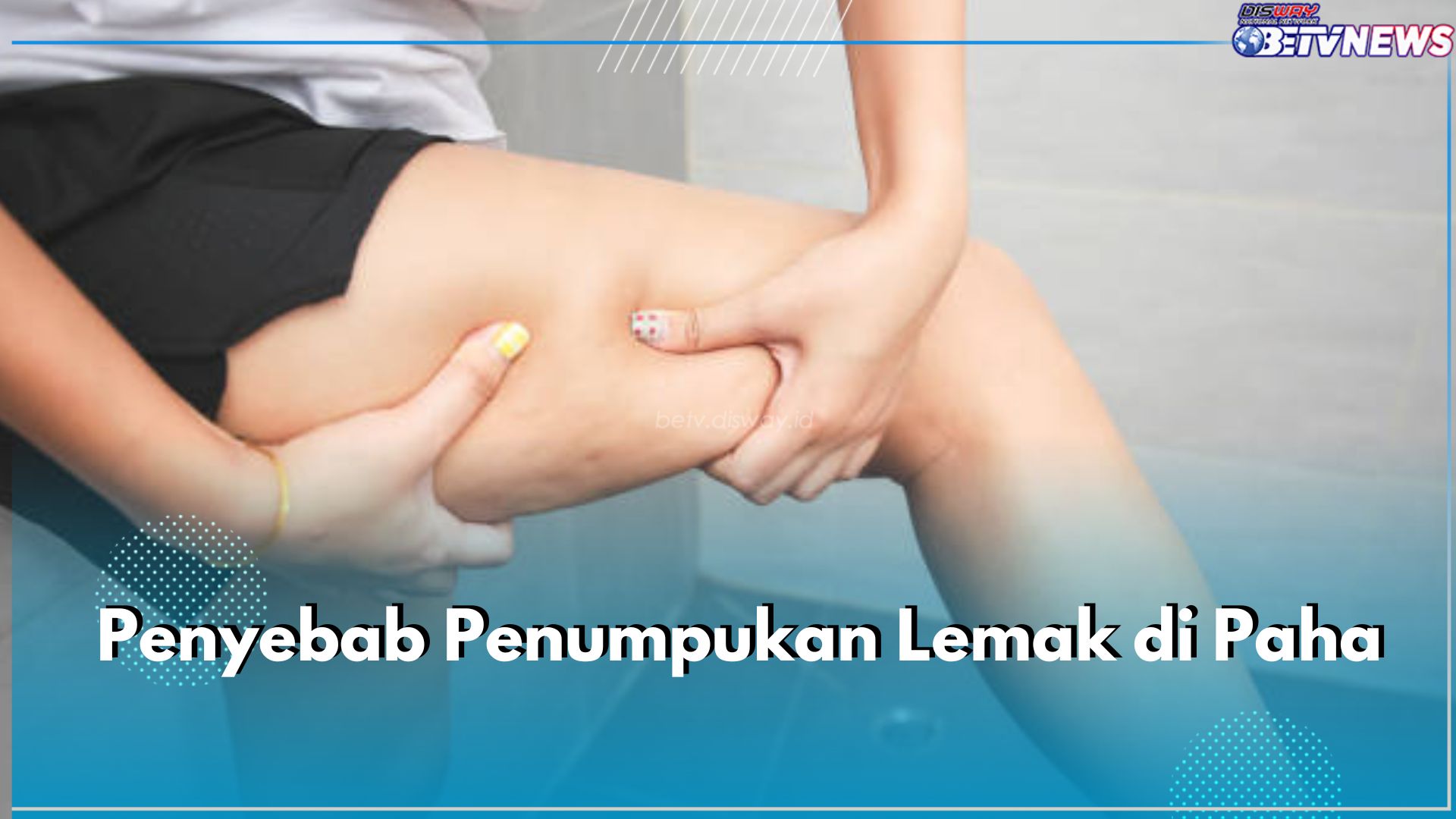 Ladies, Ini 7 Penyebab Lemak Menumpuk di Paha, Salah Satunya Stres