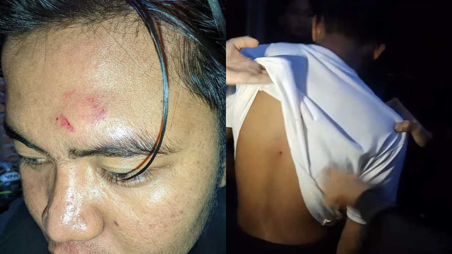 Hendak Nikmati Sunrise, 2 Pemuda Jadi Korban Penusukan Gengster di Danau Dendam Tak Sudah