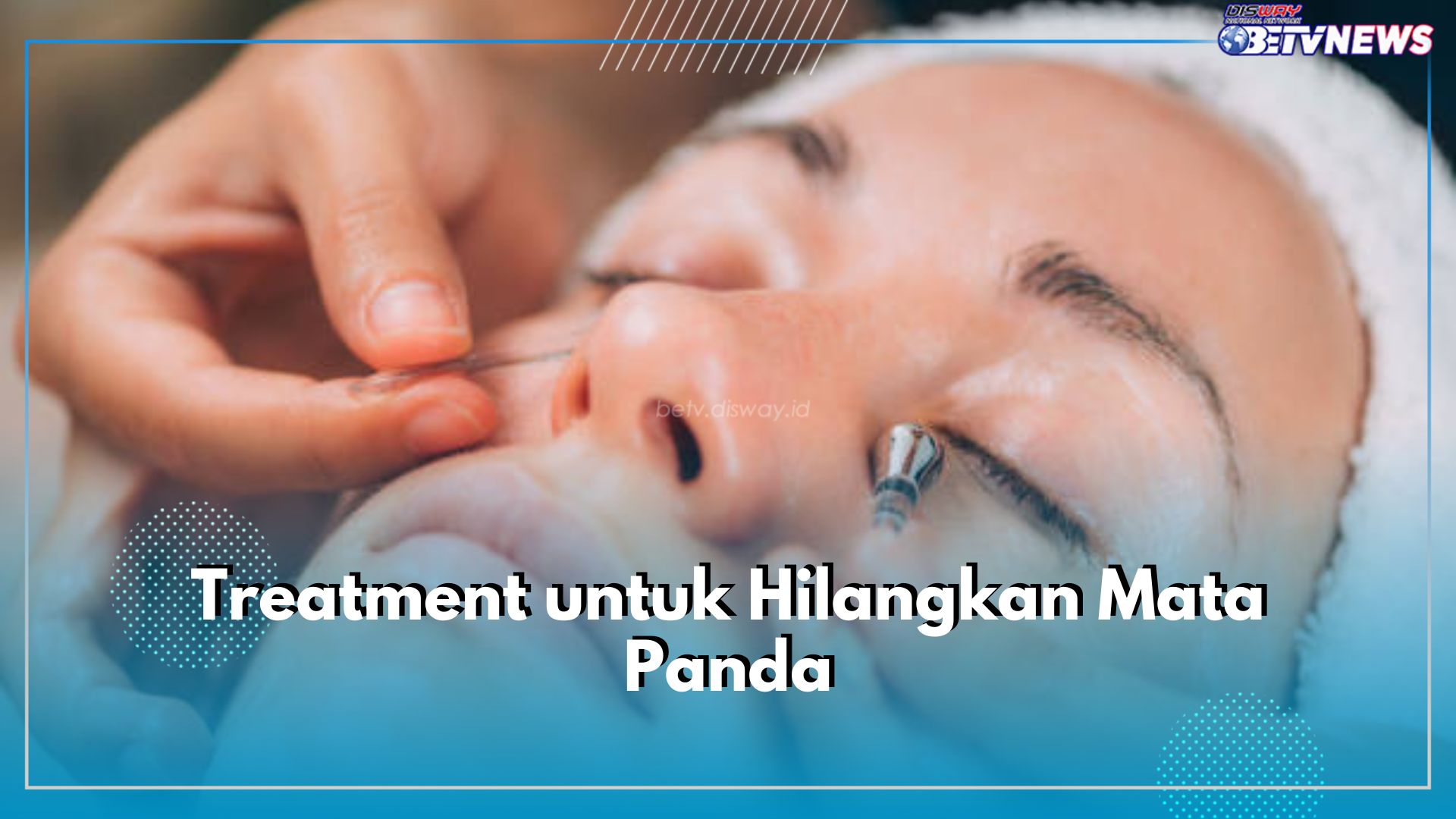 6 Treatment Ini Ampuh Hempas Mata Panda Selamanya, Cek Apa Saja!