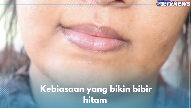 5 Kebiasaan yang Bikin Bibir Hitam, Salah Satunya Merokok, Cek yang Lain di Sini