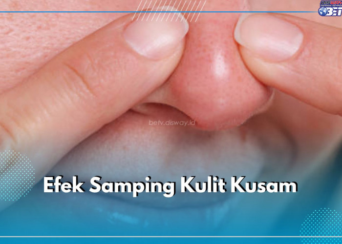 Kering dan Bertektur, Ini 7 Efek Samping Kulit Kusam Jika Tidak Dicegah