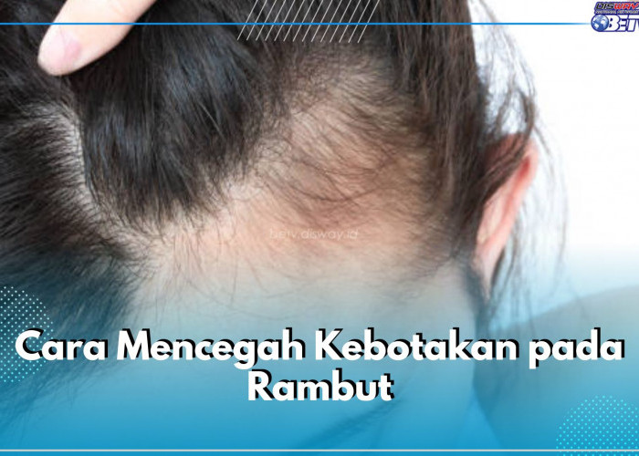 Jangan Ditunda! Ini 6 Cara Cegah Kebotakan pada Rambut, Salah Satunya Kelola Stres