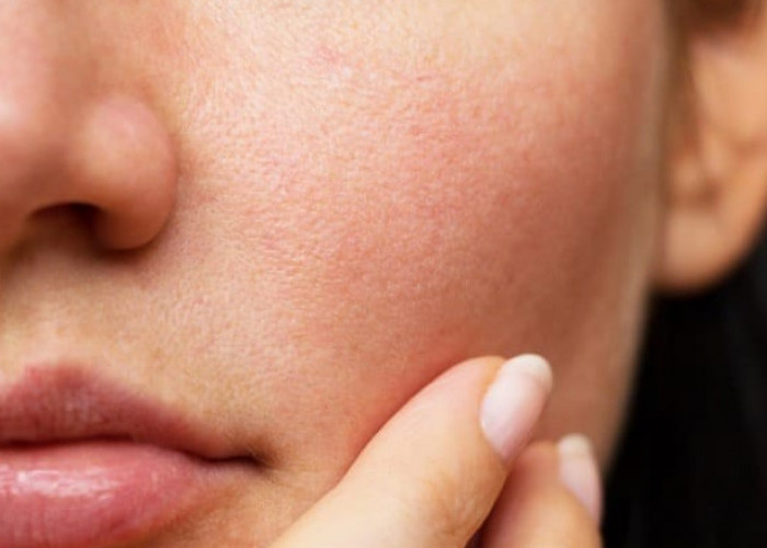 5 Cara Alami Atasi Pori-pori di Wajah, Bisa Gunakan Masker Kunyit Hingga Scrub Madu