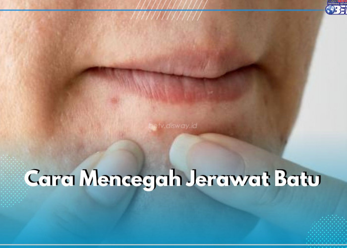 5 Cara Cegah Jerawat Batu di Wajah, Nomor 2 Paling Penting