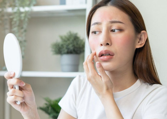 Cara Mengatasi Kulit Wajah Kering, Kulit Tetap Lembap dan Cocok untuk Sehari-hari