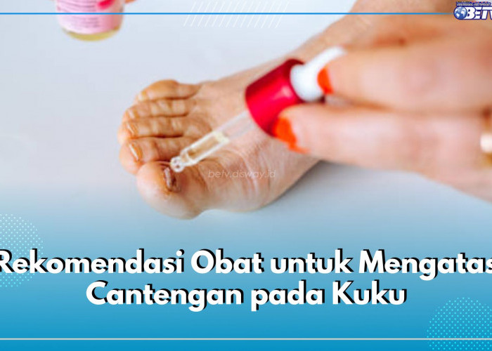 6 Rekomendasi Obat untuk Atasi Cantengan, Ada Antiseptik hingga Lotion 