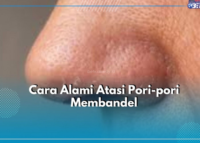 Terapkan Cara Alami Ini untuk Atasi Pori-pori di Wajah, Salah Satunya Gel Lidah Buaya