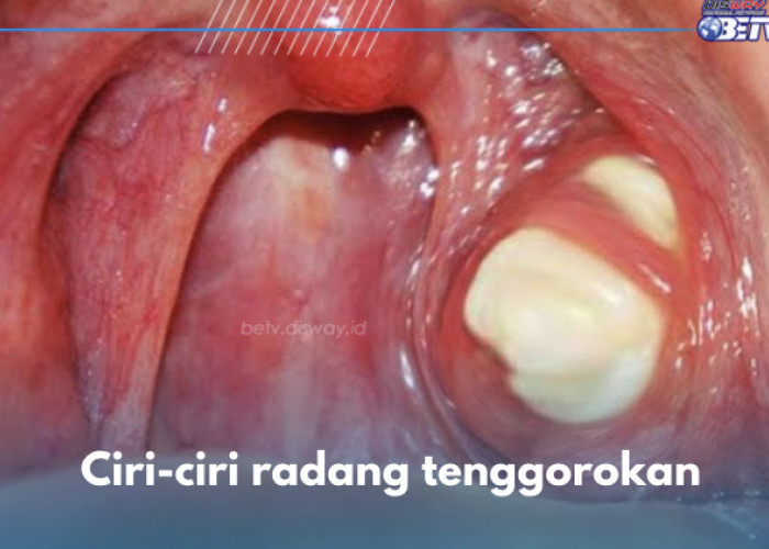 5 Ciri-ciri Radang Tenggorokan, Batuk Termasuk Salah Satunya