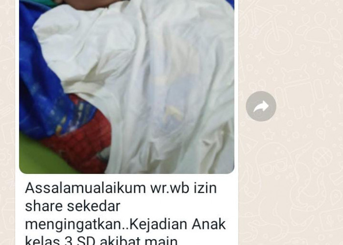 Lato-Lato Makan Korban, Beredar Kabar Seorang Siswa SD di Bengkulu Tengah Jalani Operasi Mata
