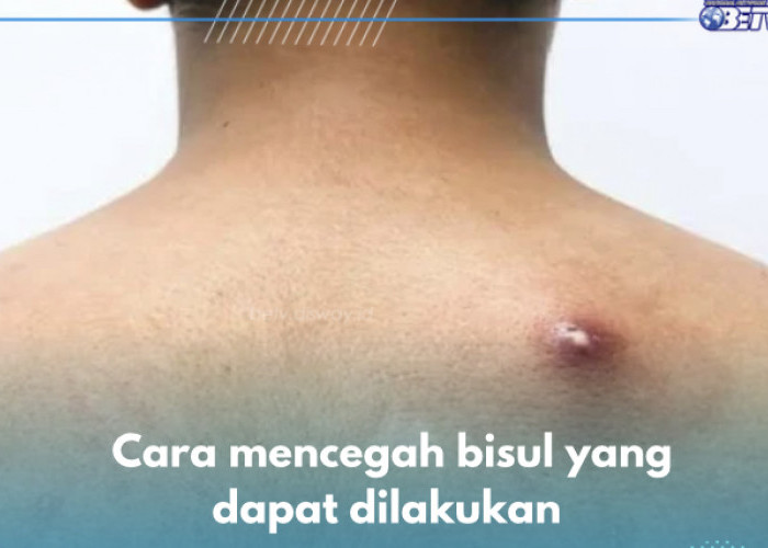 Ini 5 Cara Mencegah Bisul, Salah Satunya Ganti Pakaian Setiap Hari