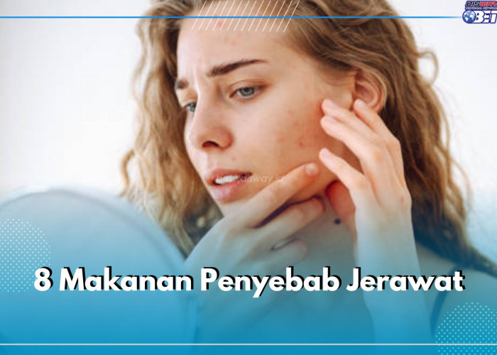 8 Makanan Penyebab Jerawat, Hati-hati dan Mesti Kamu Hindari