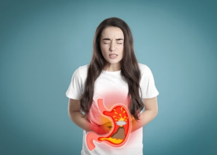 Ini Sederet Bahaya Asam Lambung Naik, Jangan Dibiarkan Begitu Saja!