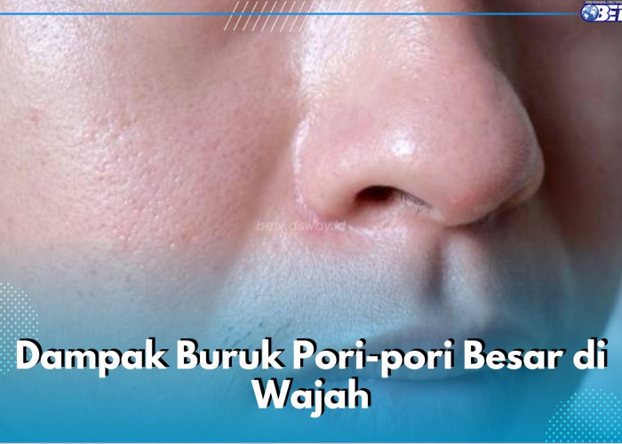 5 Dampak Buruk Pori-Pori Besar di Wajah, Bikin Kulit Rentan Berjerawat