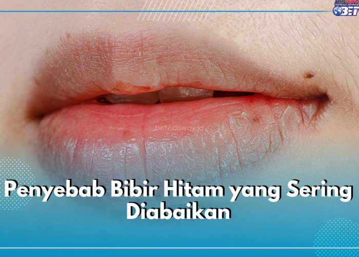 7 Penyebab Bibir Hitam Ini Sering Diabaikan, Yuk Atasi!