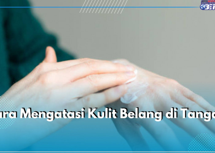 Ternyata Mudah Banget! Ini 6 Cara Atasi Kulit Belang di Tangan, Apa Saja?