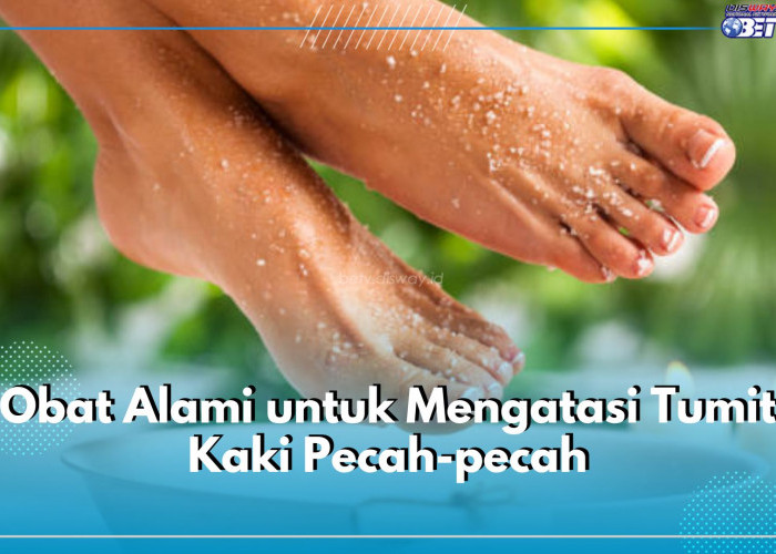 Tumit Kaki Pecah-pecah? 6 Obat Alami Ini Ampuh Mengatasinya, Cek Apa Saja!