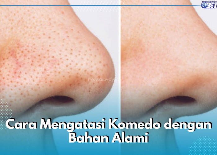 5 Bahan Alami Ini Ampuh Atasi Komedo di Wajah, Salah Satunya Masker Putih Telur