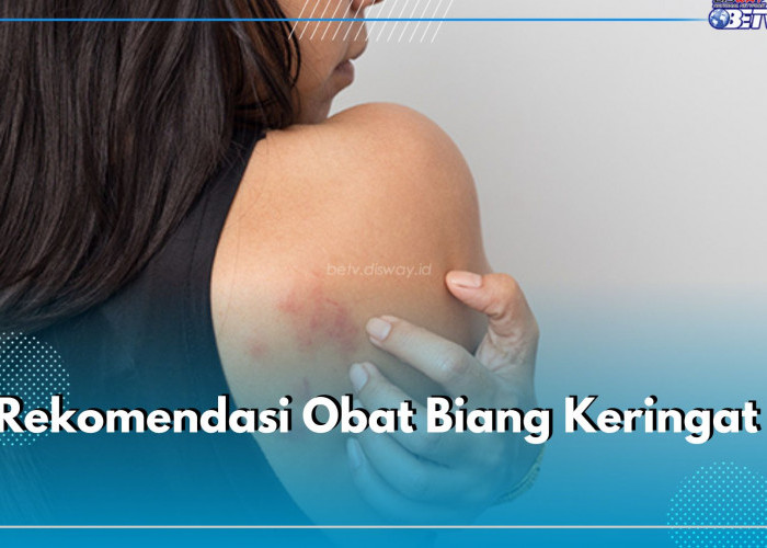 7 Rekomendasi Obat Biang Keringat untuk Orang Dewasa, Caladine Lotion hingga Herocyn Bedak Tabur