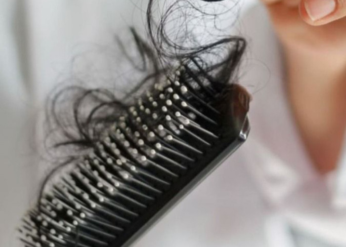 Ini Penyebab Rambut Sering Rontok yang Perlu Diketahui, Jangan Diabaikan