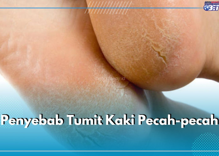 5 Penyebab Tumit Kaki Pecah-pecah, Salah Satunya Tekanan Berlebihan