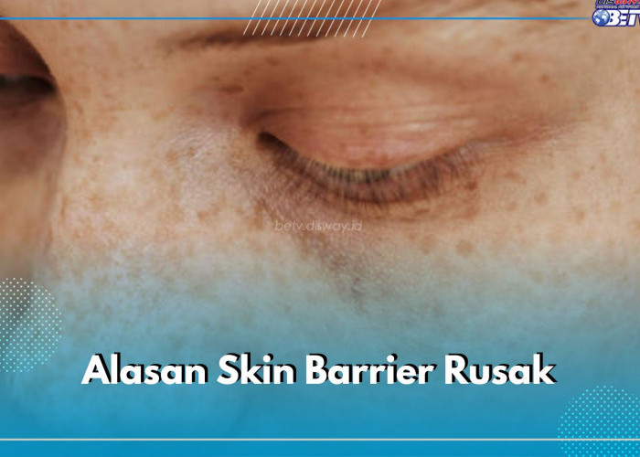 Skin Barrier di Wajah Bisa Rusak Karena 5 Hal Ini, Cek di Sini Alasannya