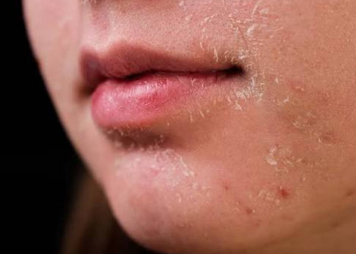 Jangan Salah Pilih! Ini Dia Rekomendasi Sunscreen untuk Pemilik Kulit Kering