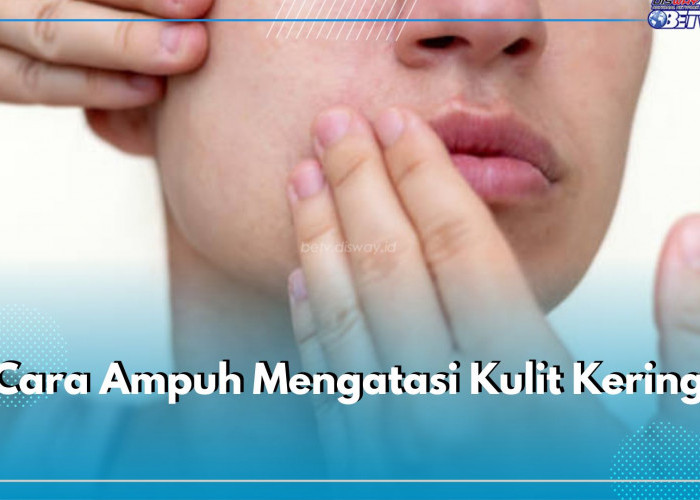 Cara Ampuh Mengatasi Kulit Kering, Pakai Bahan Alami, Ini 5 Rekomendasinya