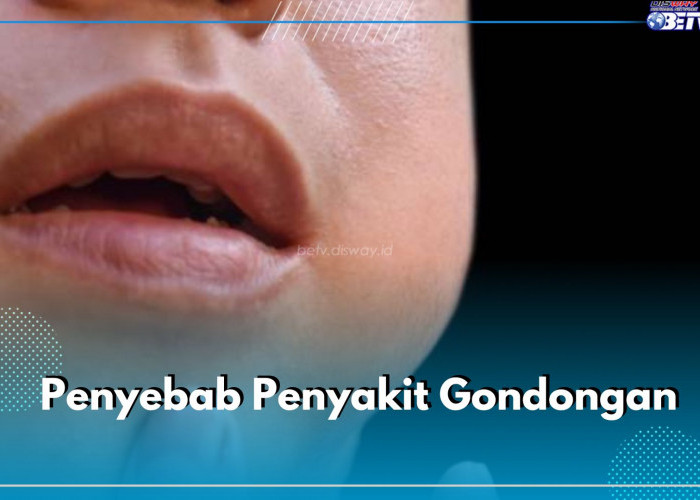 Jadi Penyakit Menular, Ketahui 6 Penyebab Penyakit Gondongan Ini untuk Menghindarinya