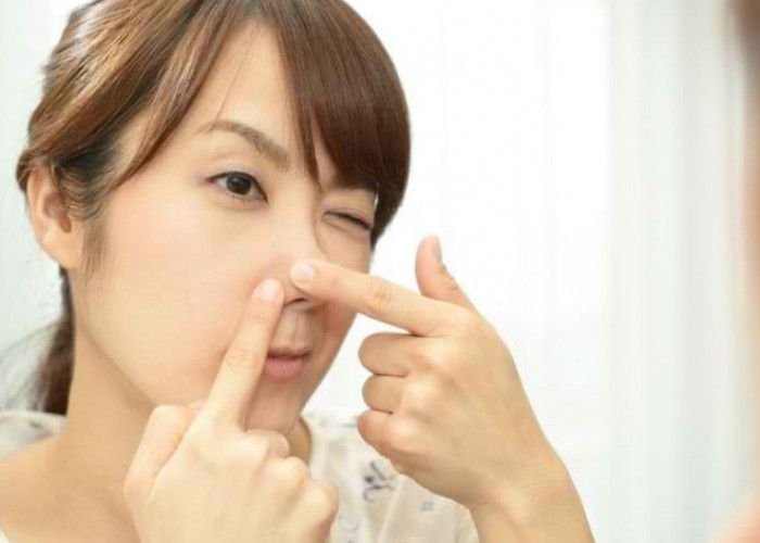 Komedo di Wajah Susah Hilang? Coba Atasi dengan 8 Rekomendasi Skincare Ini!