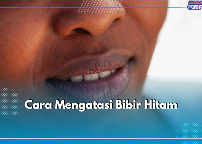 5 Cara Atasi Bibir Hitam Secara Alami, Salah Satunya Kurangi Konsumsi Kafein