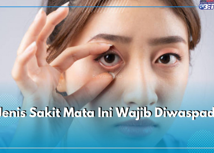 4 Jenis Sakit Mata Ini Wajib Diwaspadai, Bisa Menular dan Menimbulkan Dampak bagi Penglihatan