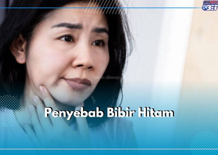 5 Penyebab Bibir Hitam yang Sering Tak Disadari, Nomor 4 Sering Dilakukan