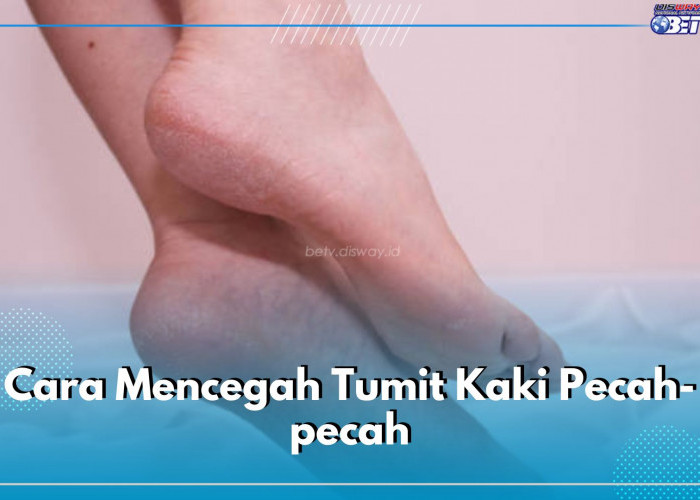 Jaga Agar Tumit Kaki Tetap Mulus dan Anti Pecah-pecah dengan 5 Cara Mudah Ini, Lakukan dari Sekarang!