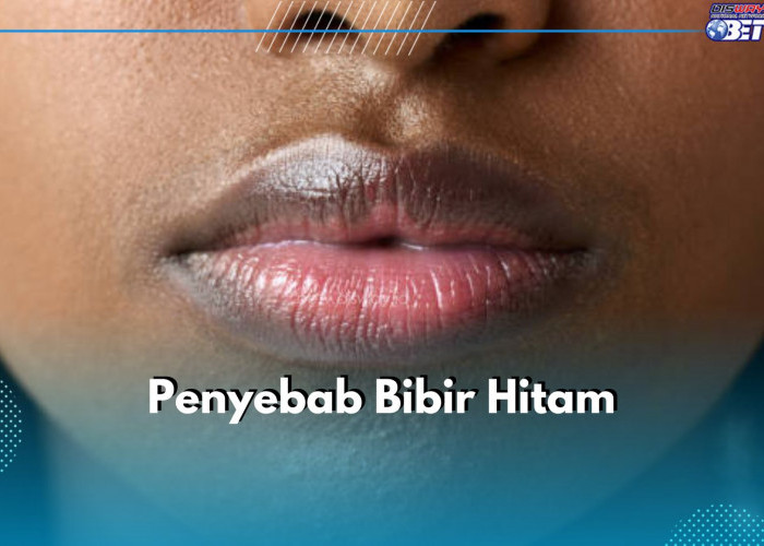 5 Kebiasaan Ini Sebabkan Bibir Jadi Hitam, Apa Saja?