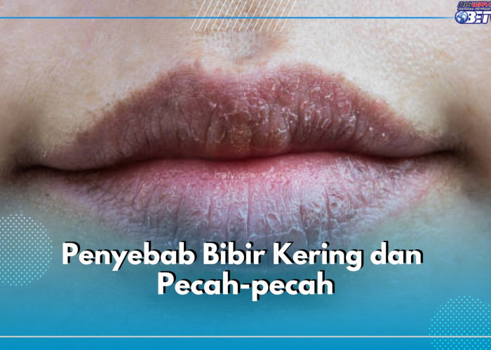 Ini 6 Penyebab Bibir Kering dan Pecah-pecah, Nomor 2 Sering Dilakukan