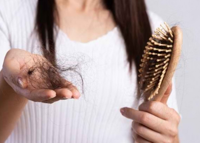 Ini 7 Penyebab Rambut Rontok yang Perlu Diwaspadai, Salah Satunya Stres Berlebihan 