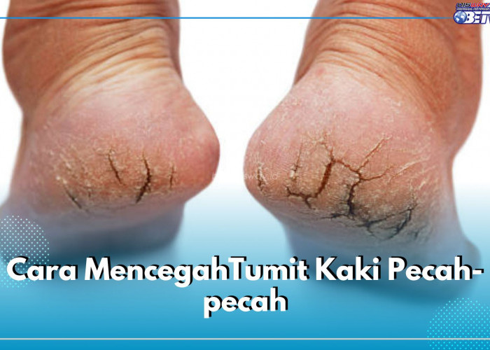 Rutin Eksfoliasi dapat Cegah Tumit Kaki Pecah-Pecah, Cek 5 Cara Lainnya di Sini!