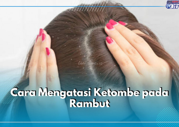 5 Cara Atasi Ketombe pada Rambut Secara Alami, Apa Saja?