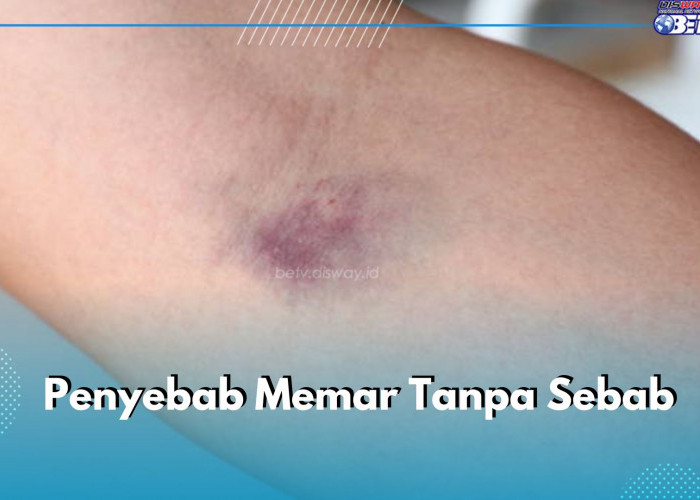 6 Penyebab Memar Tanpa Sebab di Tubuh, Salah Satunya Penyakit Autoimun