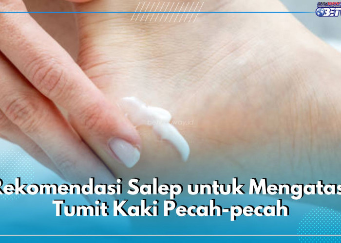  Catat! Ini 6 Rekomendasi Salep yang Ampuh Atasi Kaki Pecah-Pecah, Ada Hansaplast hingga Dermatix